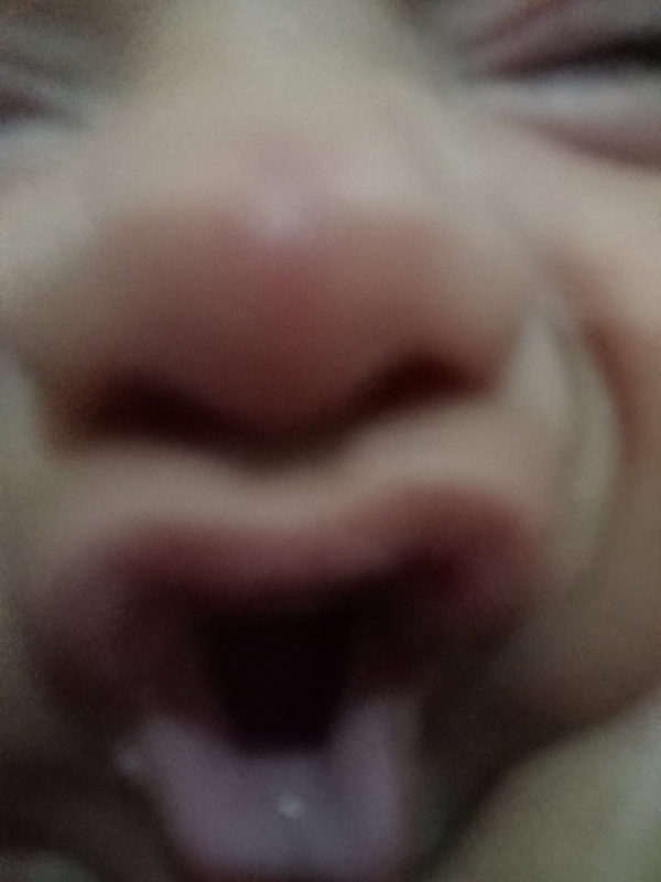 mm